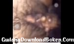 Download Bokep AIDS 3gp